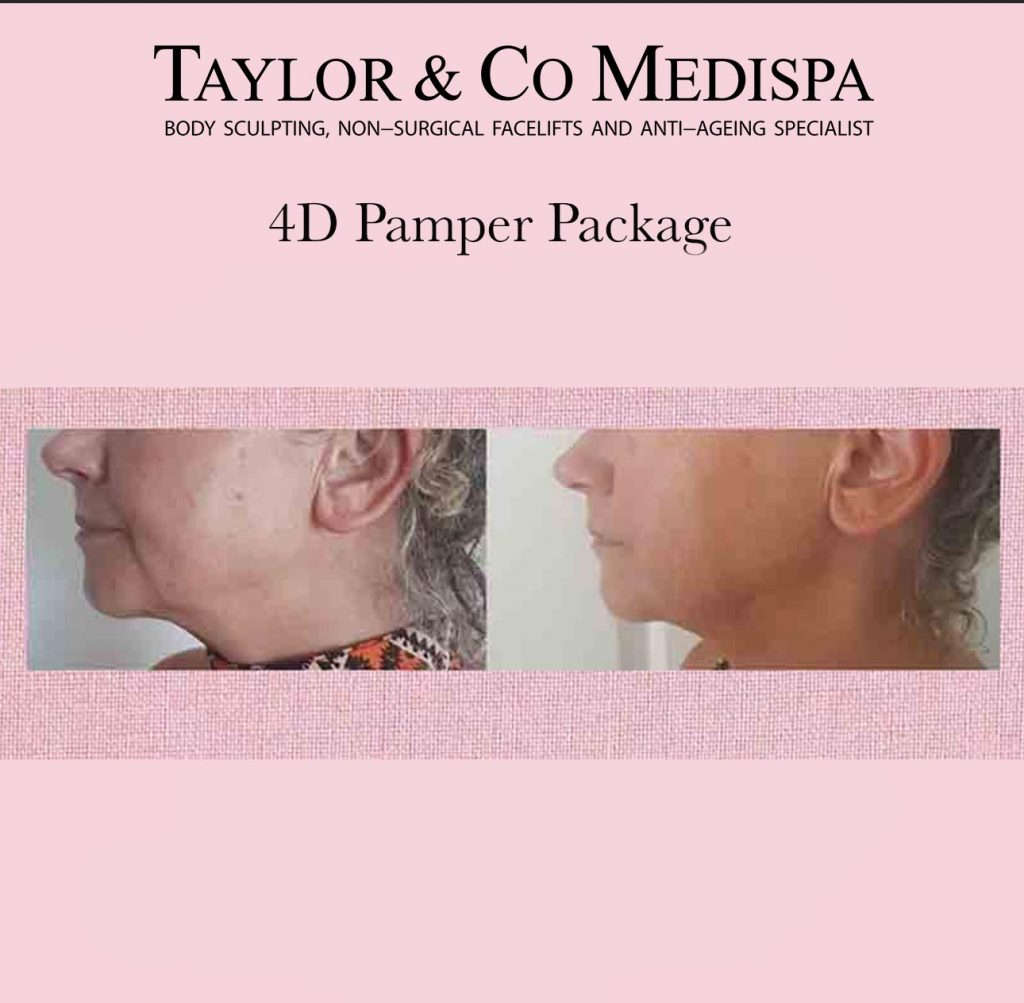 Taylor and Co Medispa Before & After HIFU Gold Coast