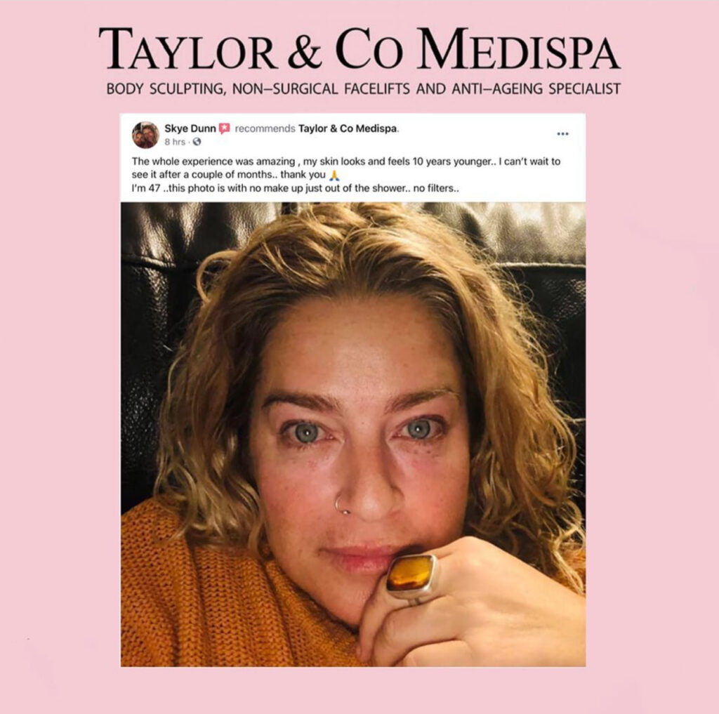 HIFU pamper package Taylor and Co Medispa Spa